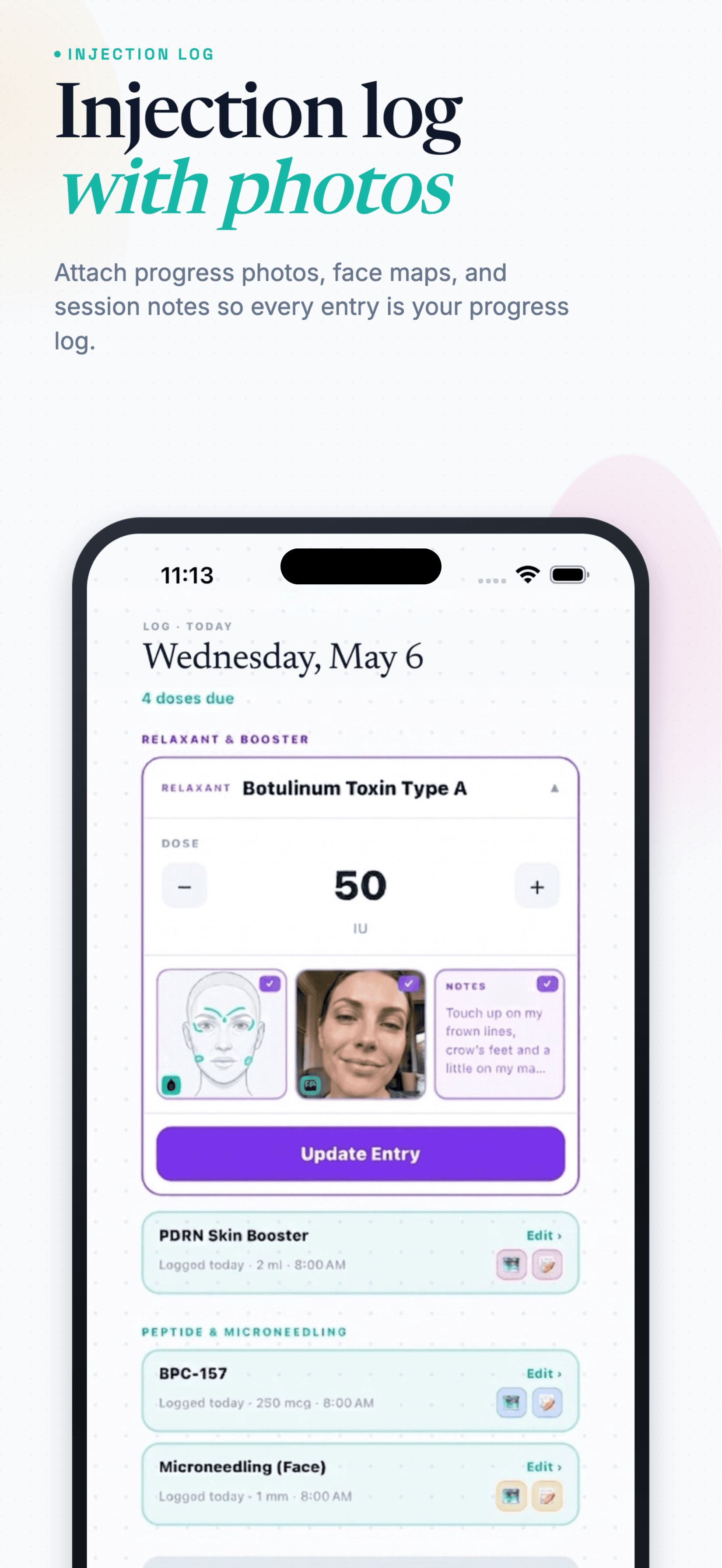 Wednesday May 6 entry with Botulinum Toxin Type A, face map, photo, and notes