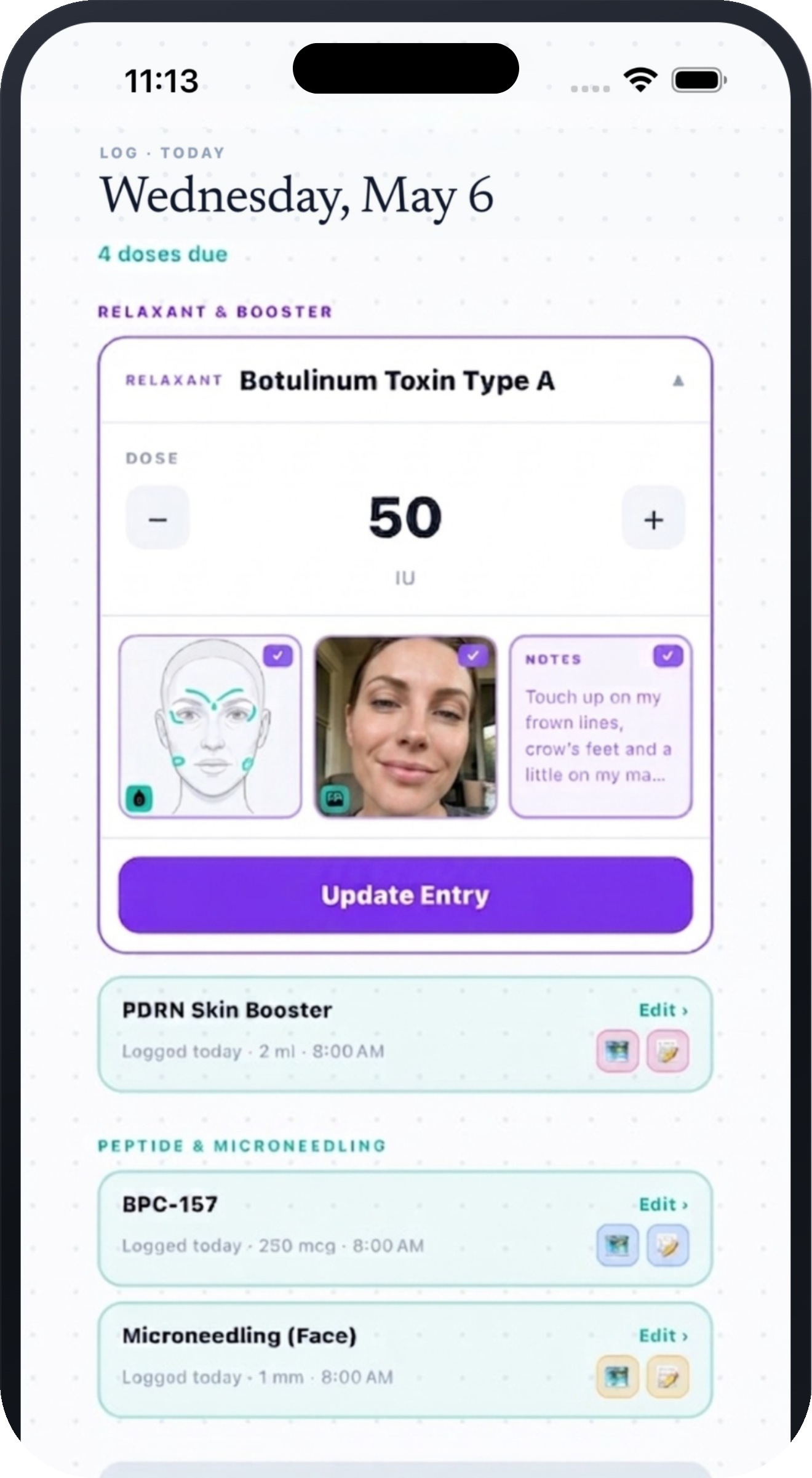 Dosefi log entry with a face-map marker, photo, and treatment notes